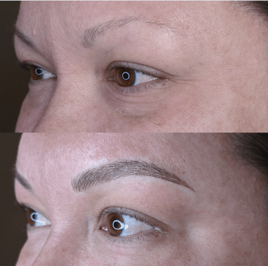 Microblading eyebrows before and after at Buckner Vein & Aesthetics.
