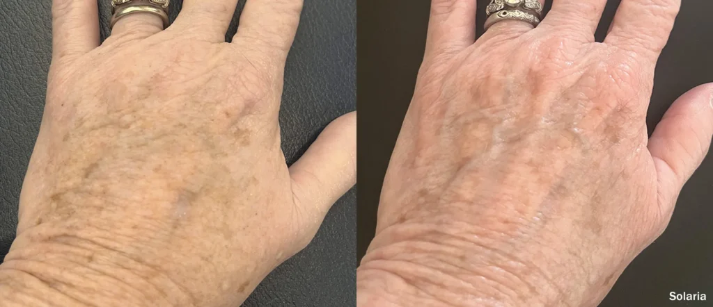 INMD Solaria Hands Female LH TM.webp