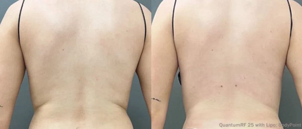 Quantum25 BA 1 2.webp