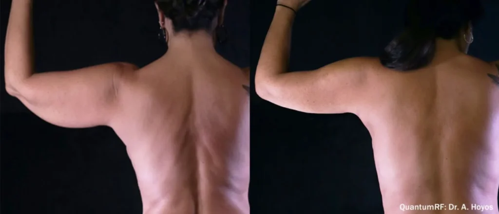 Quantum25 BA 3 3.webp