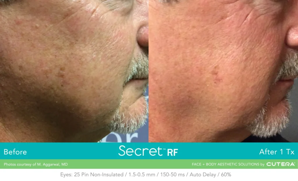 SecretRF M Aggarwal MD BA 06right scaled.webp