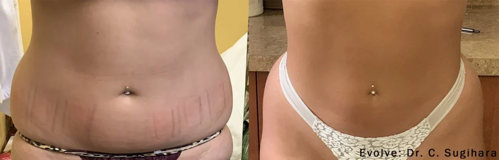 evolve before after dr c sugihara preview 1 2.webp