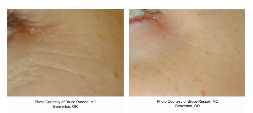 russell periocular scaled.webp