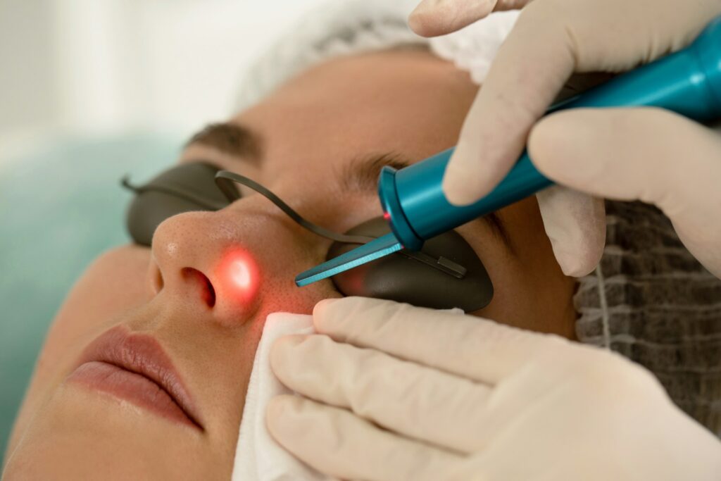 laser treatment