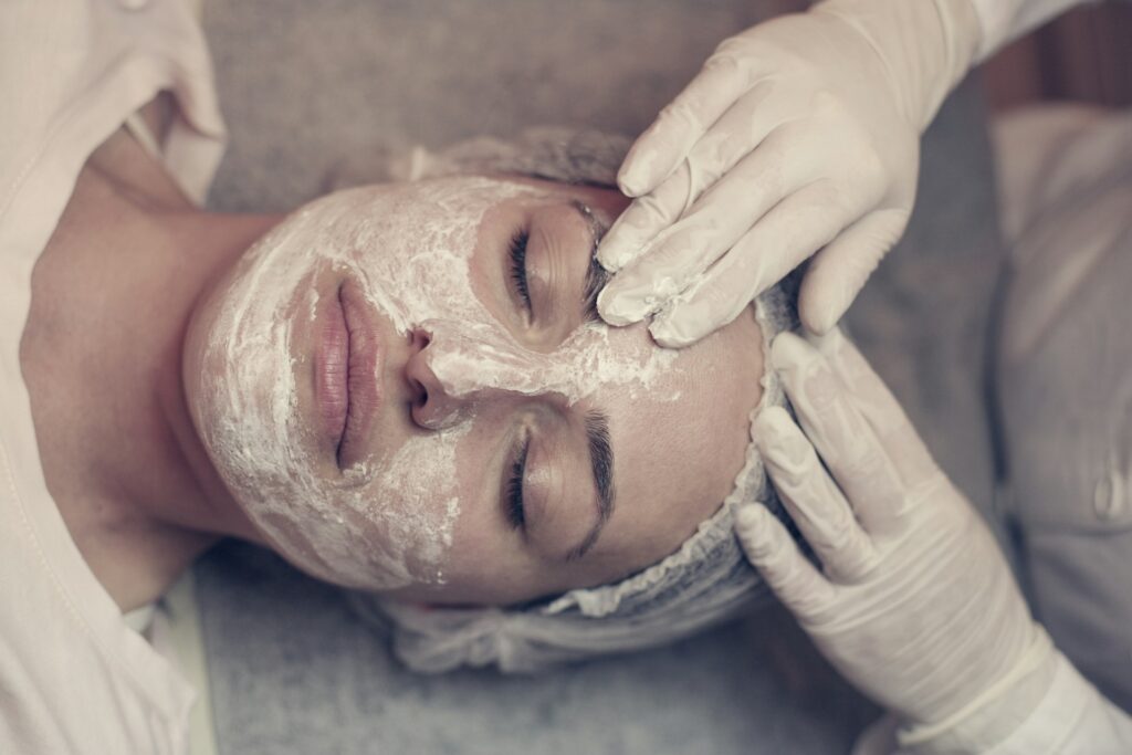 chemical peel