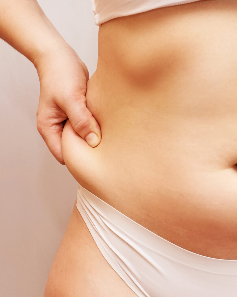 woman pinching love handles on side thinking about quantum rf treatment